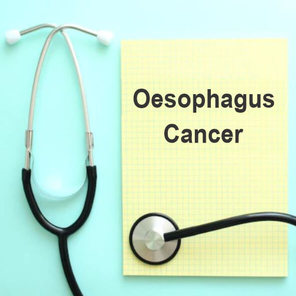 Upper endoscopy is the accepted standard for making the diagnosis of various upper gastrointestinal including esophageal cancers...